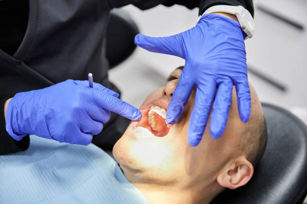 Best Emergency Cosmetic Dentistry (e.g., broken veneers) in Flowood, MS